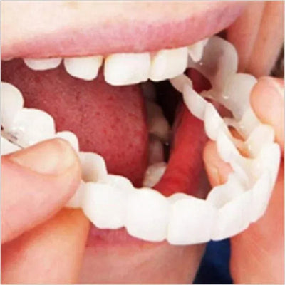 Snap On Smile Braces Premium Quality
