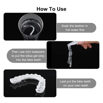 Snap On Smile Braces Premium Quality